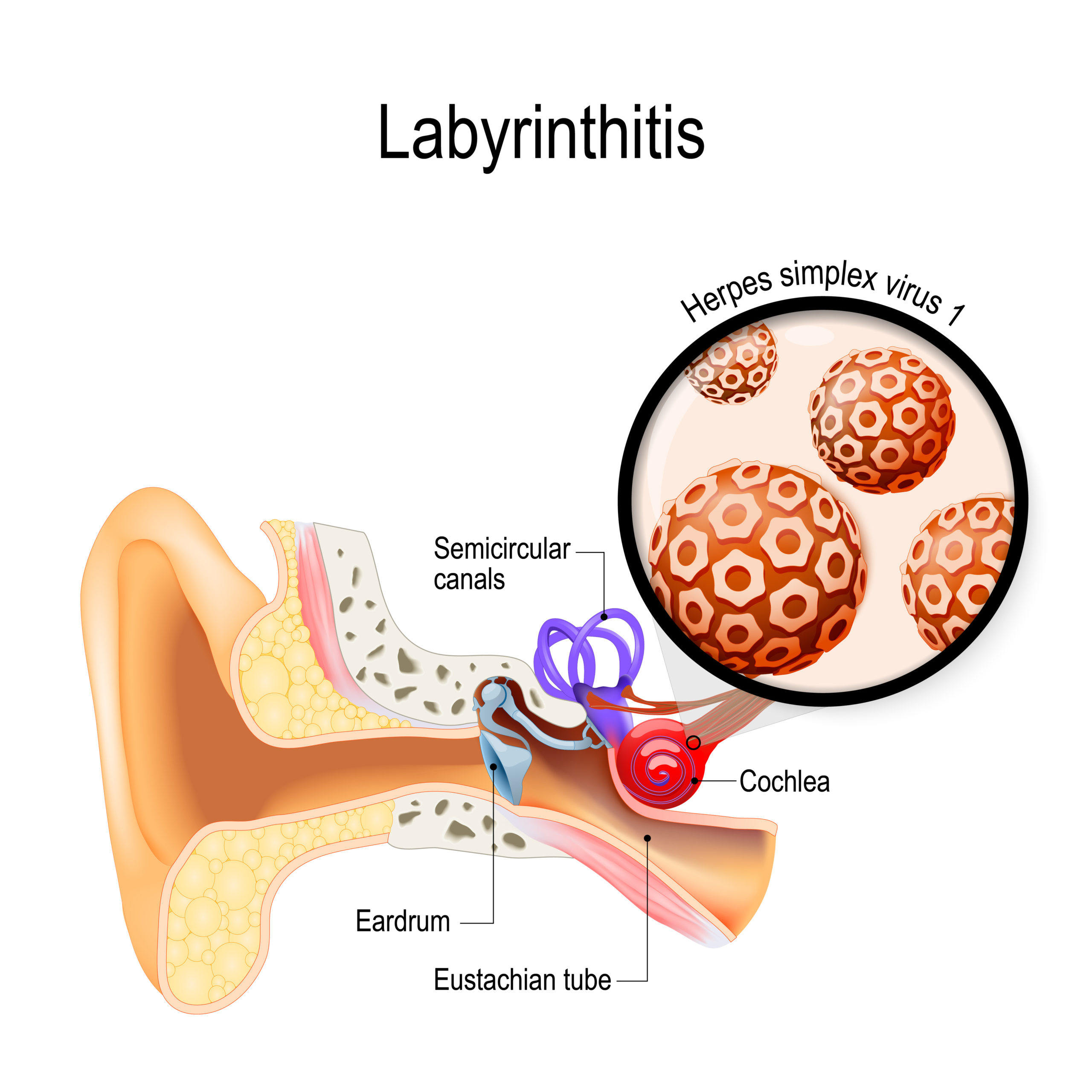 Medizinische Illustration des Ohrs mit Beschriftung zu Labyrinthitis und Herpes-simplex-Virus Medizinische Illustration des Ohrs mit Beschriftung zu Labyrinthitis und Herpes-simplex-Virus
